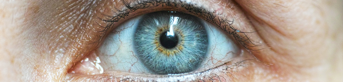 What Causes Bloodshot Eyes